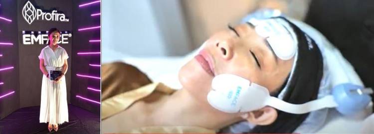 Profira EMFACE Wujudkan Awet Muda & Kulit Kencang, Treatment Non-Surgical Face Lifting dengan Teknologi Advance