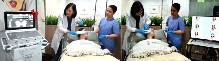 Ingin Kulit Kencang Tanpa Operasi? Profira Punya Solusi Perawatan Ultherapy Prime