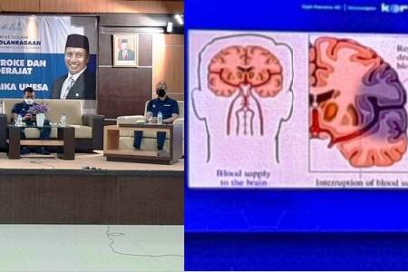 Cegah Stroke dengan Rutin Berolahraga; Jadikan Sebagai Kebutuhan