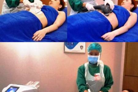 Miliki Tubuh Ideal dengan Lipocav 3.0; Gunakan Advanced Technology 3 in 1