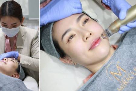 Miracle Tawarkan Power Glaze Duo, Gabungkan Teknologi RFMicroneedling dan Exosome