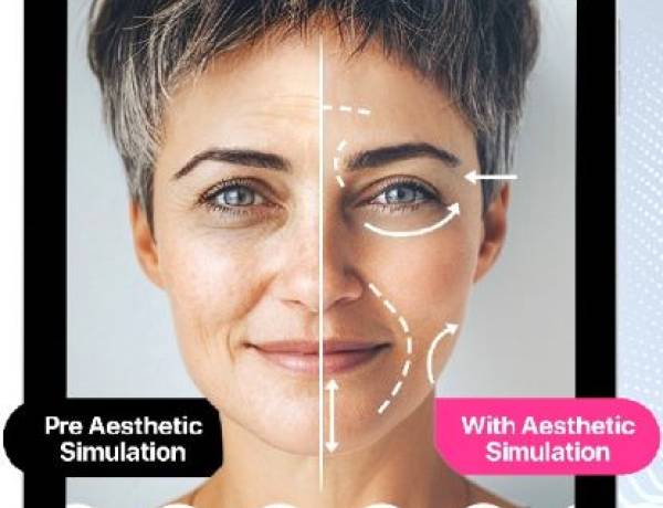 Skincare Pro Aesthetic Simulator, Solusi Berteknologi AI untuk Simulasi Prosedur Estetika Non-Bedah