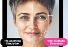 Skincare Pro Aesthetic Simulator, Solusi Berteknologi AI untuk Simulasi Prosedur Estetika Non-Bedah